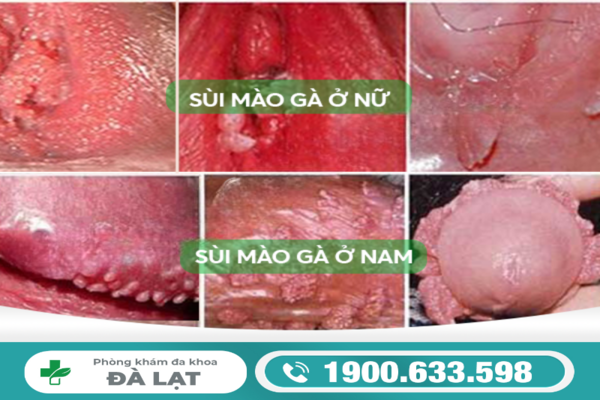 Hình ảnh minh họa